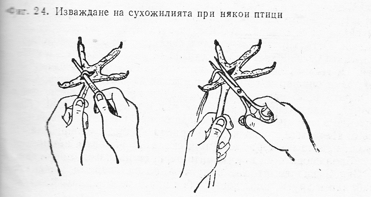 Изваждане на сухожилията