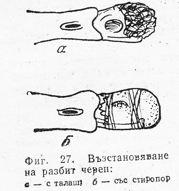 Възстановяване на череп