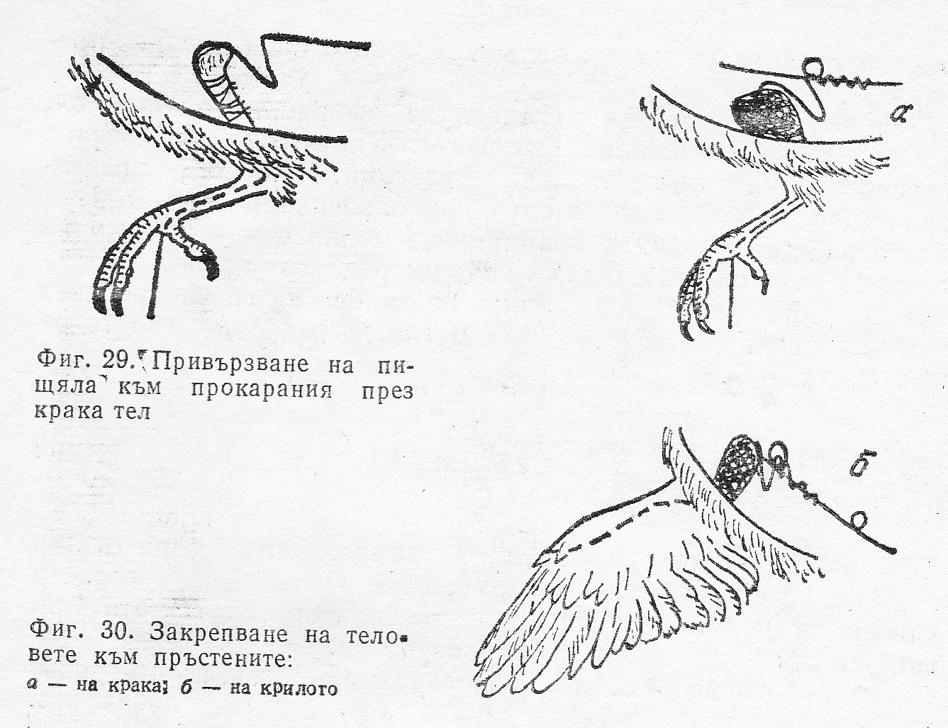 Привързване на пищяла