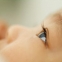 Проблеми на кърмаческата възраст - Болести на устата и очите на бебето
