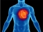 Обиколката на шията предсказва риска от сърдечни болести