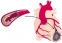 Симптоми на сърдечна атака при жените