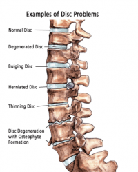 Как се диагностицират болките в гърба?