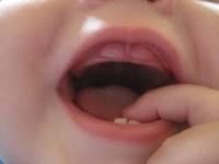 Поникване на зъбите на бебето
