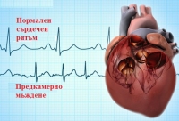 Предупредителни сигнали и нужда от спешна помощ при предсърдно мъждене